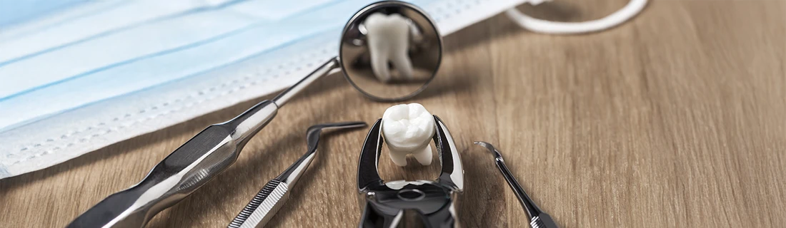Tooth Extractions in San Diego CA
