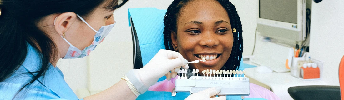 Veneers in San Diego CA